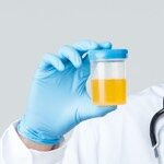 Urine Analysis